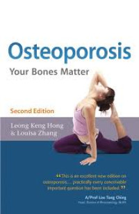 Image of Osteoporosis : Your Bones Matter, Second Edition